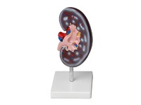 Модель почки в разрезе - fgospostavki.ru - Дмитров