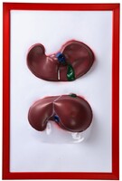 Барельефная модель "Печень" - fgospostavki.ru - Дмитров